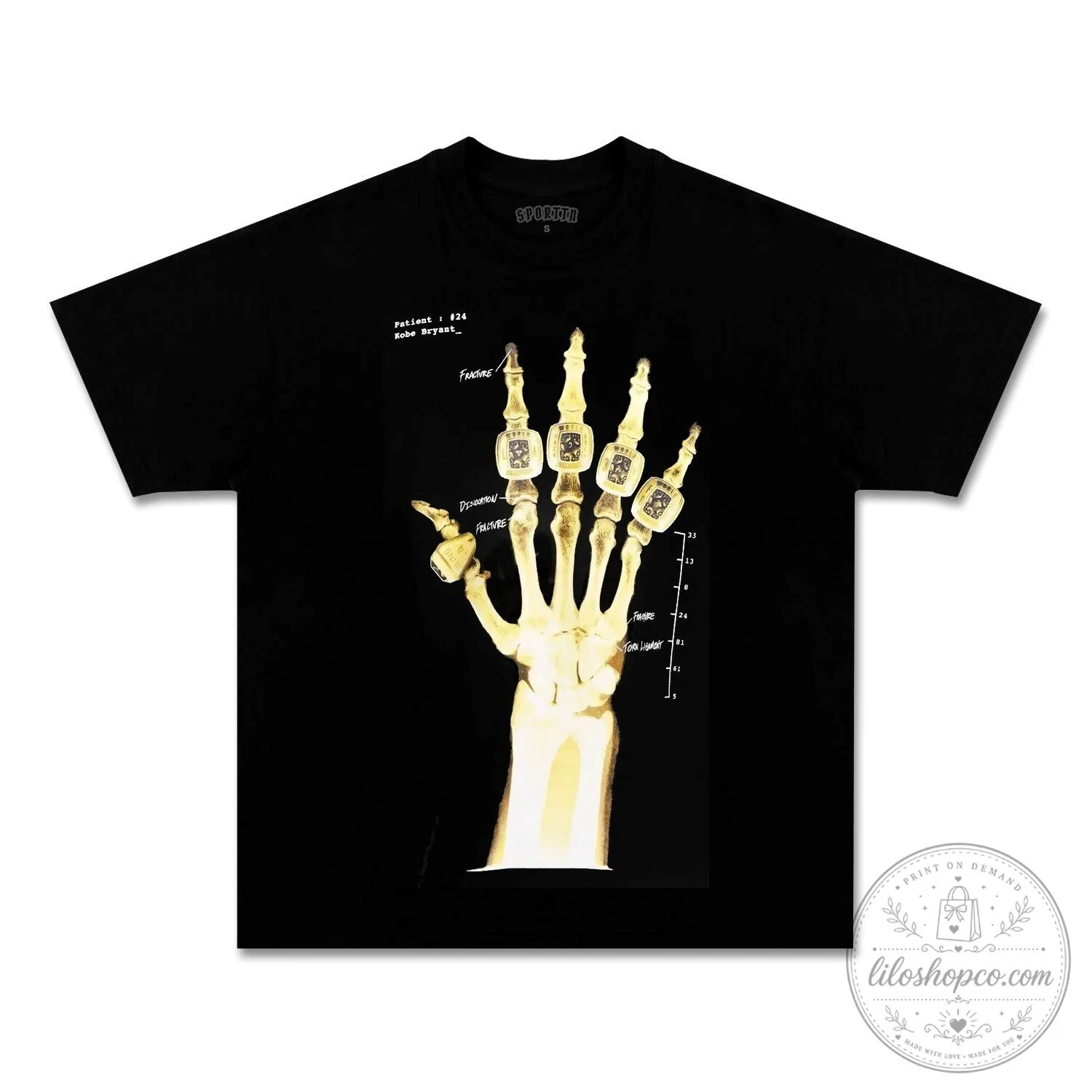 Kobe Bryant X-Ray Hand Fracture Broken Not Beaten Black T-Shirt